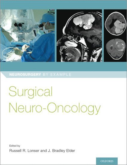 Surgical Neuro-Oncology 1