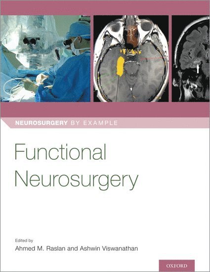 Functional Neurosurgery 1