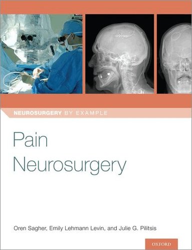 Oren Sagher, Emily Levin, Julie Pilitsis - Pain Neurosurgery, Häftad