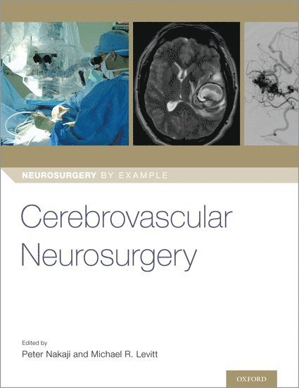 Cerebrovascular Neurosurgery 1
