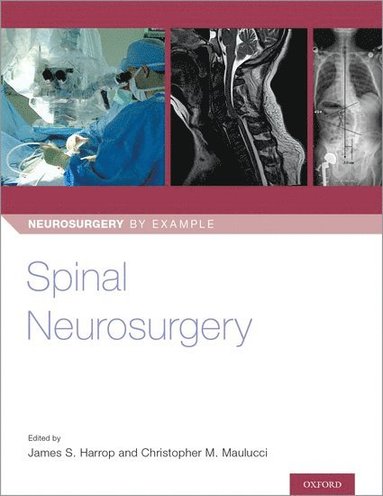 bokomslag Spinal Neurosurgery