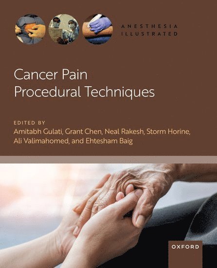 Cancer Pain Procedural Techniques 1