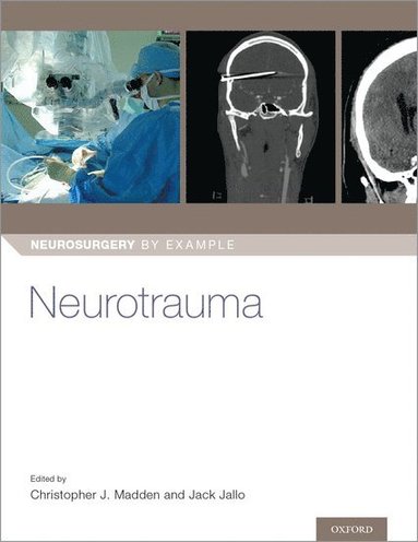 bokomslag Neurotrauma