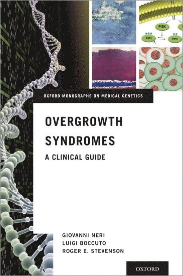 Overgrowth Syndromes 1