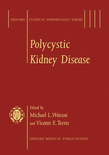 Michael L. Watson, Vicente E. Torres - Polycystic Kidney Disease, Inbunden