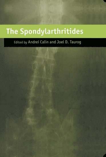 The Spondylarthritides 1