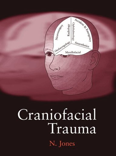 Nick Jones - Craniofacial Trauma, Inbunden