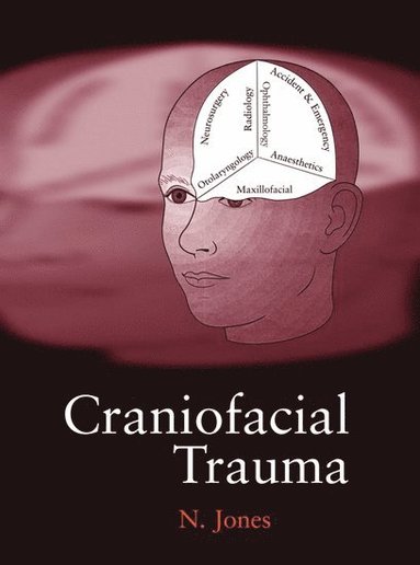 bokomslag Craniofacial Trauma
