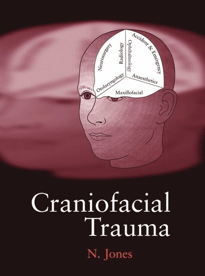 Nick Jones, Nottingham) Jones, Nick (Consultant Otorhinolaryngologist, Consultant Otorhinolaryngologist, Queen's Medical Centre - Craniofacial Trauma, Inbunden