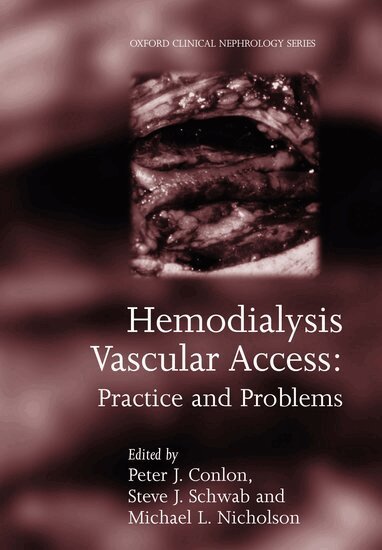 Peter Conlon, Michael Nicholson, Steve Schwab - Hemodialysis Vascular Access, Inbunden