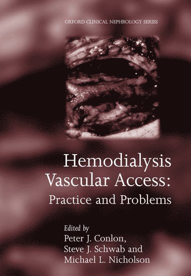 Hemodialysis Vascular Access