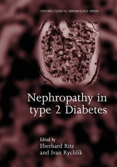 Eberhard Ritz, Ivan Rychlik - Nephropathy in Type 2 Diabetes, Inbunden