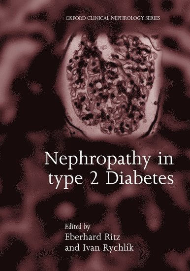 Nephropathy in Type 2 Diabetes