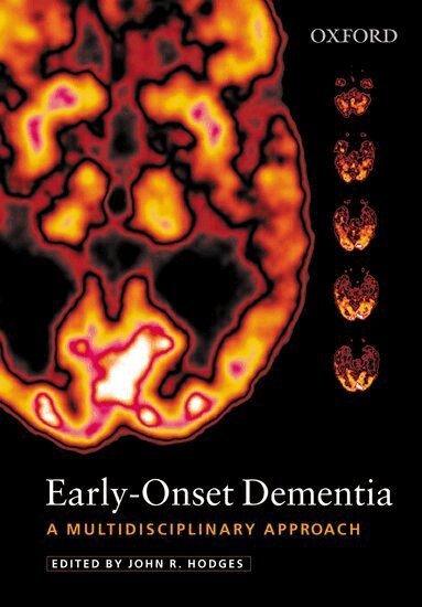 John Hodges - Early-Onset Dementia, Inbunden