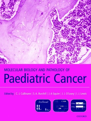 bokomslag Molecular Biology and Pathology of Paediatric Cancer