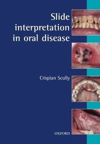 bokomslag Slide Interpretation in Oral Diseases