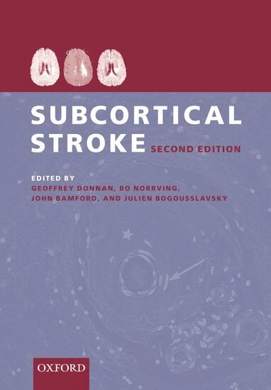 Geoffrey Donnan, Bo Norrving, John Bamford, Julien Bogousslavsky - Subcortical Stroke, Inbunden