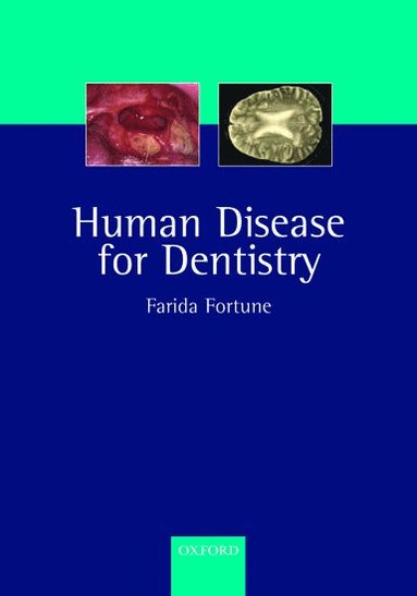 bokomslag Human Disease for Dentistry