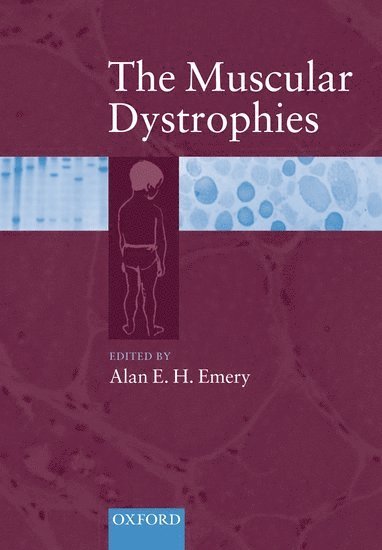 Alan E H Emery, Exeter UK) Emery, Alan E H (, Department of Neurology, Royal Devon and Exeter Hospital - The Muscular Dystrophies, Inbunden