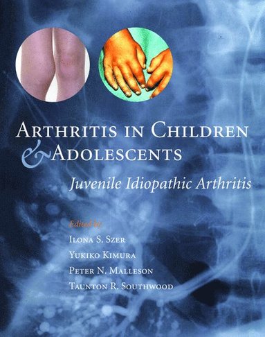 bokomslag Arthritis in Children and Adolescents