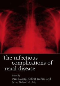 bokomslag Infectious Complications of Renal Disease