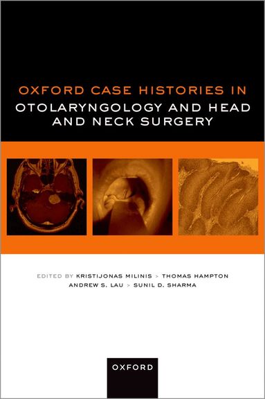 Kristijonas Milinis, Thomas Hampton, Andrew S. Lau, Sunil D. Sharma - Oxford Case Histories in Otolaryngology and Head and Neck Surgery, Häftad