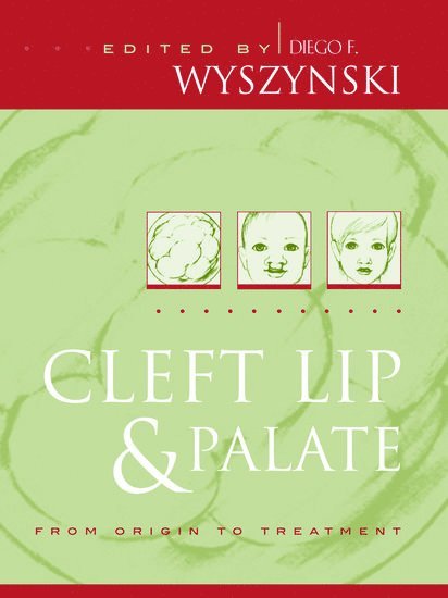 Diego F. Wyszynski, Massachusetts) Wyszynski, Diego F. (Genetics Program, Department of Medicine, Boston University School of Medicine and Department of Epidemiology, Boston University School of Public Health, Boston, Massachusetts, Genetics Program, Department of Medicine, Boston University School of Medicine and Department of Epidemiology, Boston University School of Public Health, Boston - Cleft Lip and Palate, Inbunden
