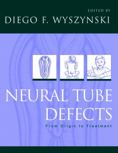 bokomslag Neural Tube Defects