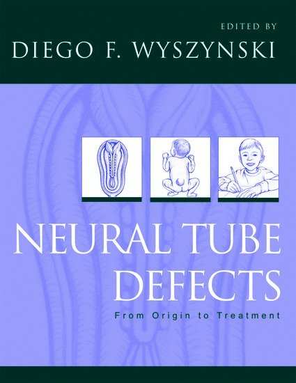 Neural Tube Defects 1