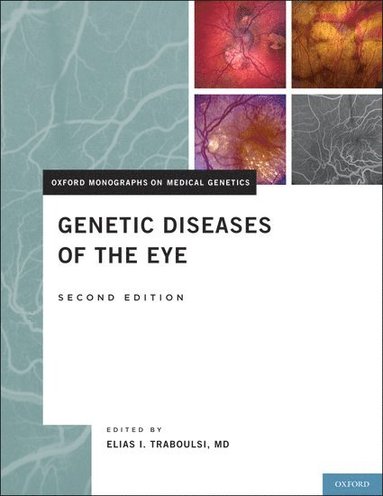 bokomslag Genetic Diseases of the Eye