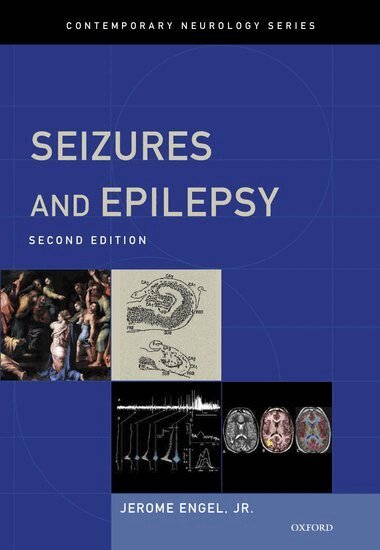Jerome Engel, Jr. - Seizures and Epilepsy, Inbunden