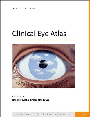 Daniel Gold, Richard Lewis - Clinical Eye Atlas, Inbunden