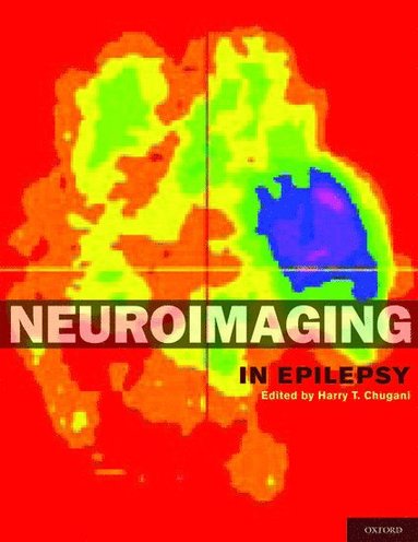 bokomslag Neuroimaging in Epilepsy