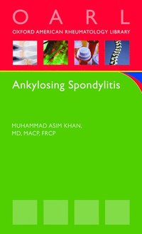 bokomslag Ankylosing Spondylitis