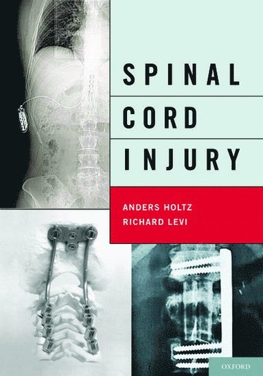 bokomslag Spinal Cord Injury