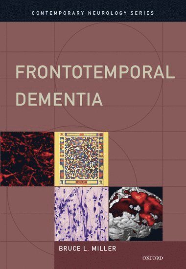 Frontotemporal Dementia 1