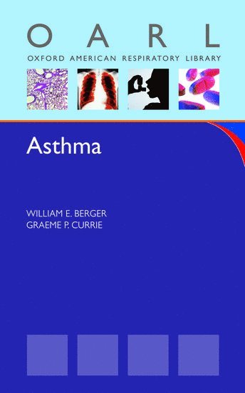 William Berger, CA) Berger, William (Clinical Professor at the College of Medicine, Clinical Professor at the College of Medicine, Department of Pediatrics, Division of Allergy and Immunology, University of California, Irvine, Irvine, William E. Berger - Asthma, Häftad