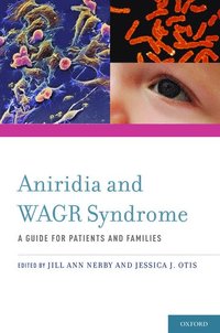 bokomslag Aniridia and WAGR Syndrome