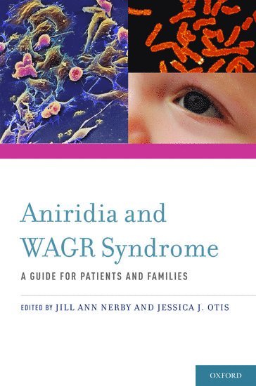 Aniridia and WAGR Syndrome 1