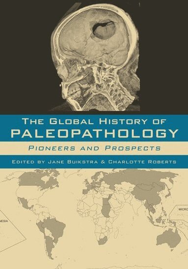 BUIKSTRA, Jane Buikstra, Charlotte Roberts - The Global History of Paleopathology, Inbunden