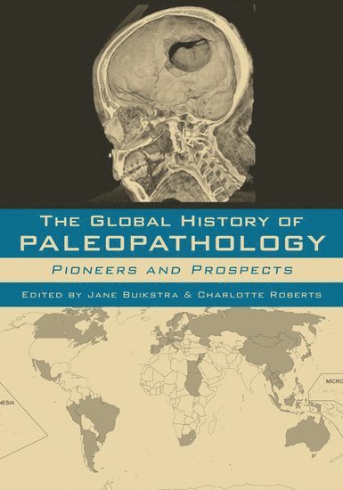 The Global History of Paleopathology 1