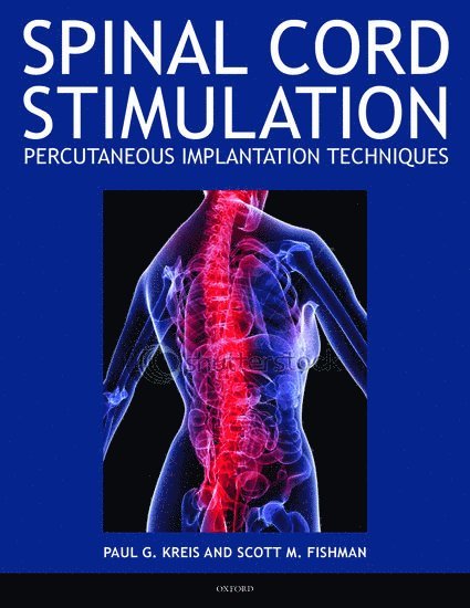 Paul Kreis, Scott Fishman - SPINAL CORD STIMULATION, Inbunden