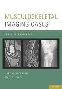 bokomslag Musculoskeletal Imaging Cases