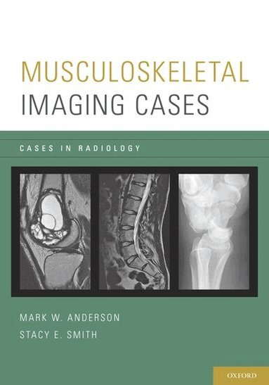 Mark W. Anderson, Stacy E. Smith - Musculoskeletal Imaging Cases, Häftad