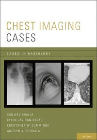 bokomslag Chest Imaging Cases