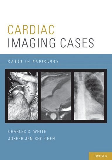 Charles White, Joseph Chen - Cardiac Imaging Cases, Häftad