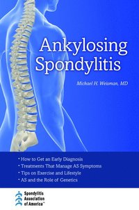 bokomslag Ankylosing Spondylitis