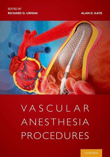Richard Urman, Alan Kaye - Vascular Anesthesia Procedures, Häftad