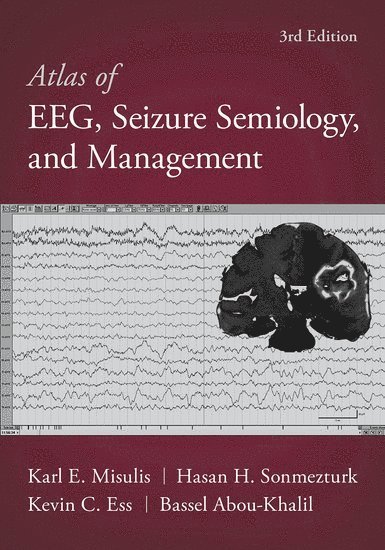 Atlas of EEG, Seizure Semiology, and Management 1