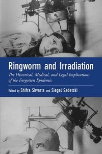 bokomslag Ringworm and Irradiation
